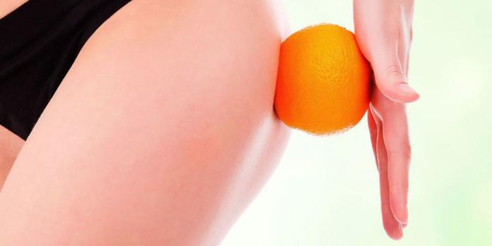 Вся правда про целюліт: чи здатні салонні процедури здолати «апельсинову кірку»