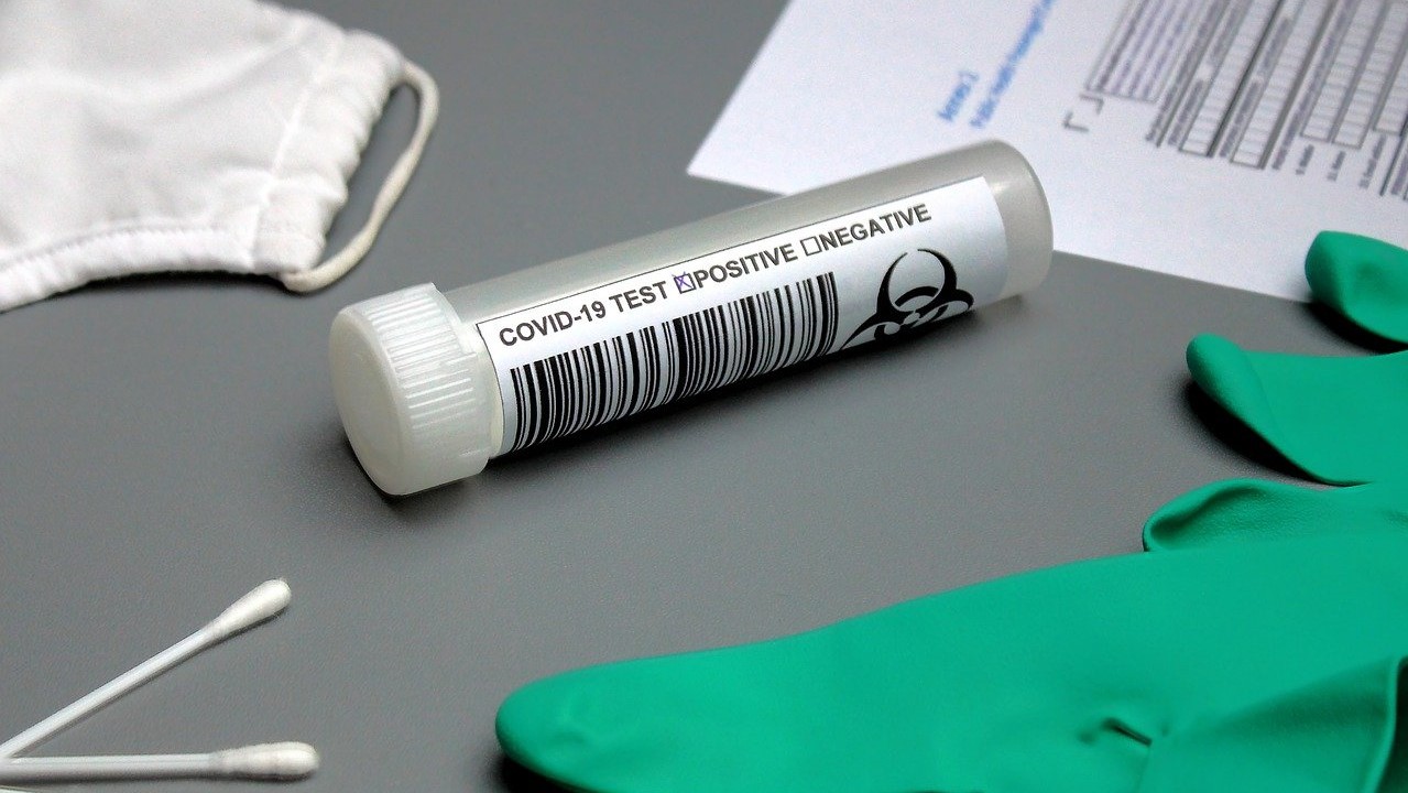 ПЛР-тест на коронавірус. Фото: Pixabay