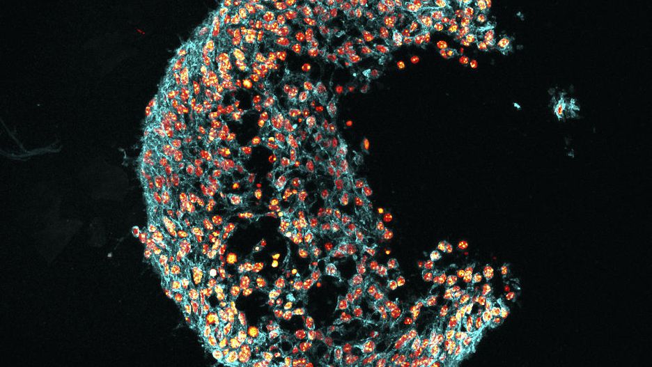«Круассан», автор Casey Ah Cann. На фото изображены легочные стволовые клетки, выращенные в лаборатории в форме пневмосферы.