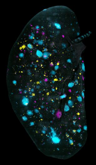 «Брызги краски на легких», автор Caleb Dawson. На фото показаны разноцветные опухоли, которые ученые специально выращивали и вводили в легкое, чтобы изучить их поведение. 