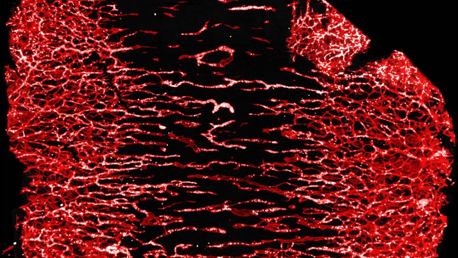«Зустріч на півдорозі», автор Alison Farley. На фото показані кровоносні судини і білі кров’яні клітини, що мігрують з ембріональної тканини миші. Це був експеримент про роль тромбоцитів у розвитку кровоносних судин.