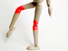 Уникальная медицина: в Британии создали новый коленный сустав после ампутации ноги (ФОТО)
