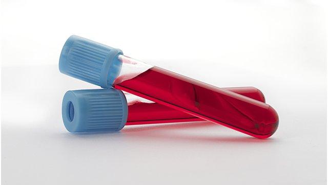 Новий тест крові може вберегти від зловживання антибіотиками