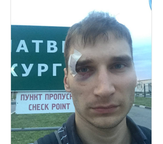 Террористы ДНР при задержании повредили глаз российскому журналисту