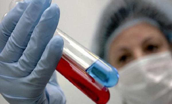 На Донеччині через ускладнення від грипу з початку року померло 15 осіб