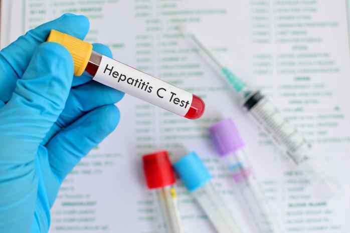 Що робити, якщо вам поставили діагноз вірусний гепатит С