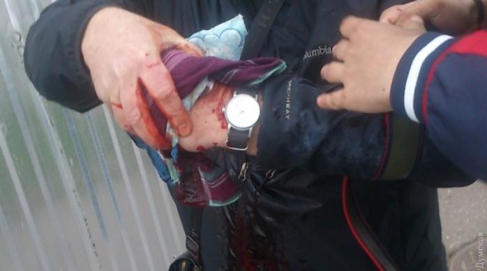 В Одессе в руках активиста взорвалась траурная лампадка