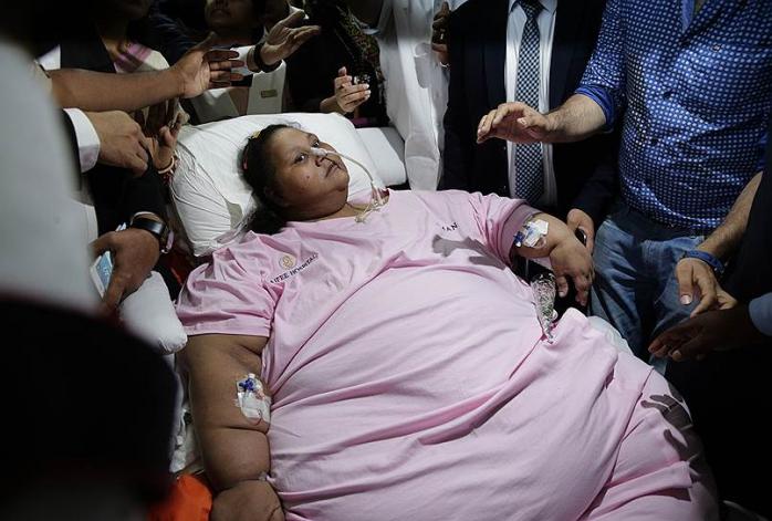 Самая толстая женщина в мире умерла, успев похудеть на 300 кг (ФОТО)