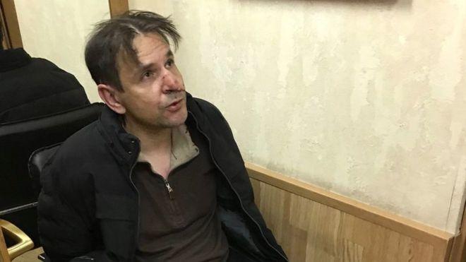 Суд арестовал мужчину, порезавшего российскую журналистку