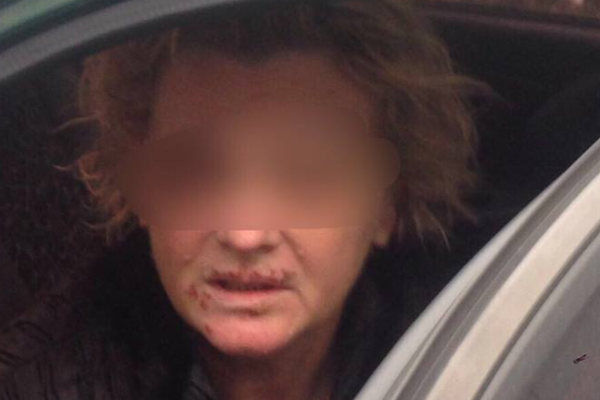 Тримали у підвалі та знущалися: під Києвом 62-річну жінку викрали разом з автомобілем (ФОТО)