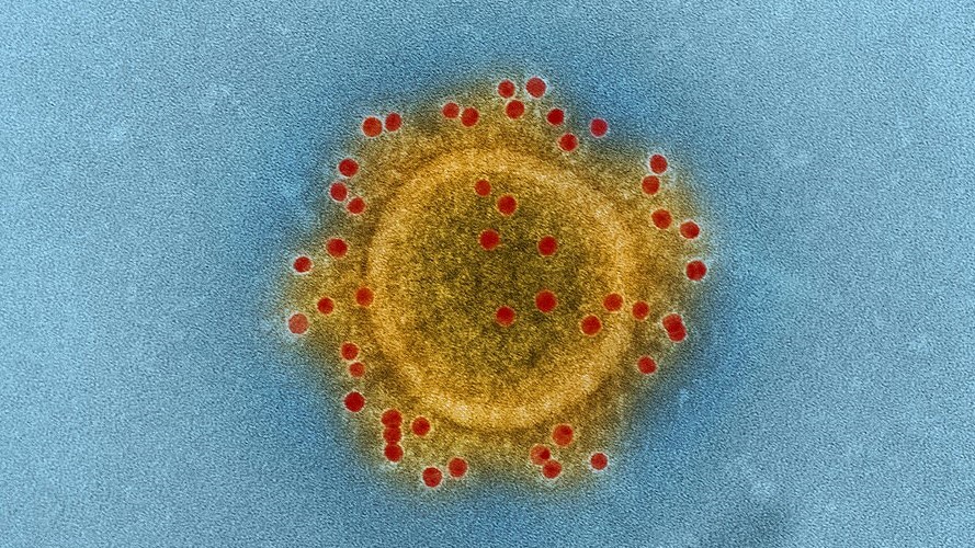 Коронавирус MERS. Фото: NIAID / Flickr