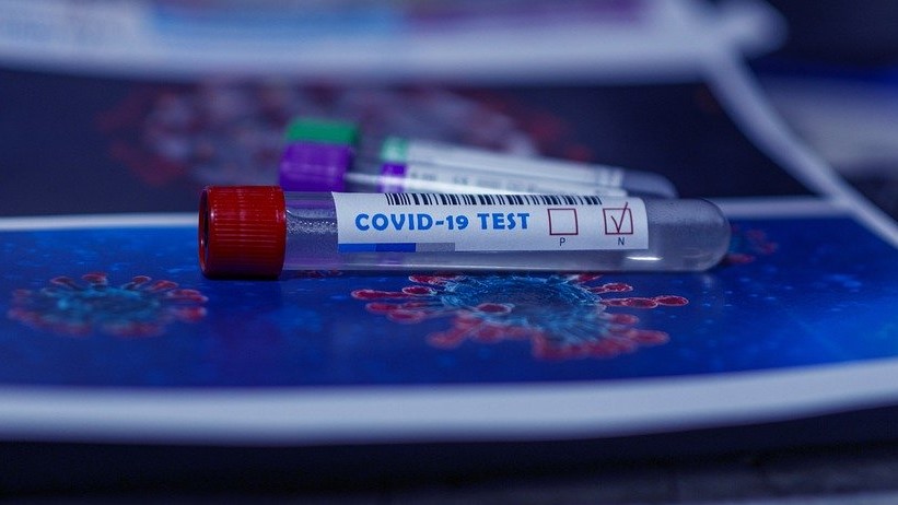 Тест ПЛР на коронавірус. Фото: Pixabay