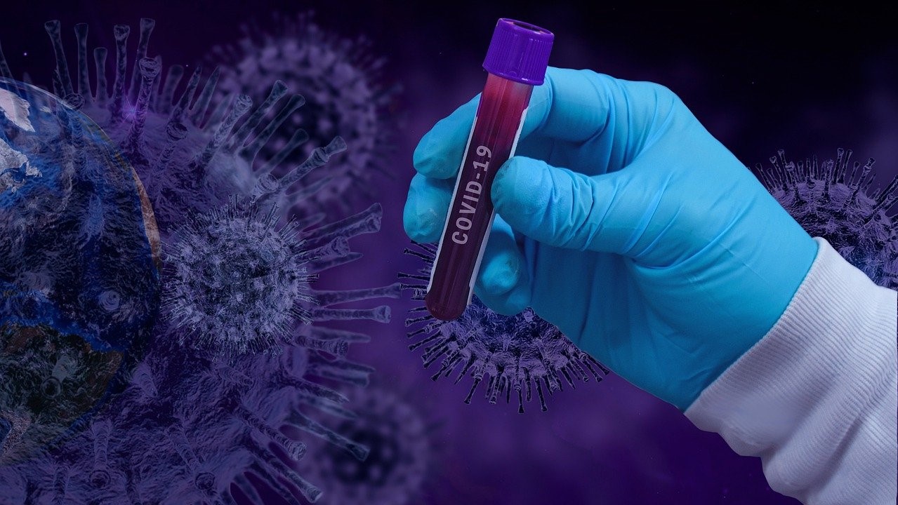 Тест ПЛР на коронавірус. Фото: Pixabay