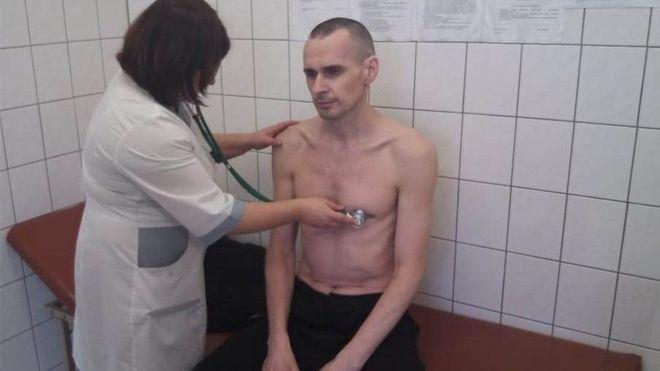 Сенцов у колонії під час медогляду на початку жовтня, фото - BBC