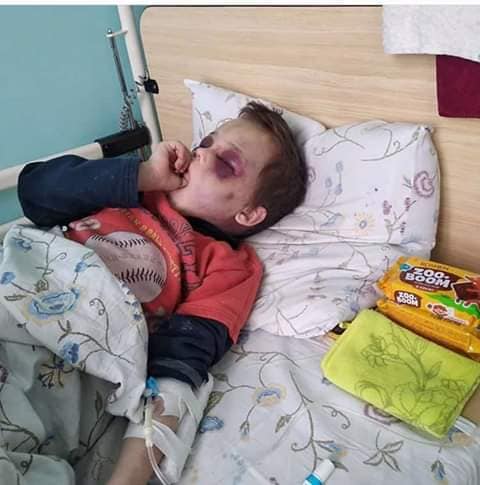 Избитый в Винницкой области мальчик, фото — Фейсбук