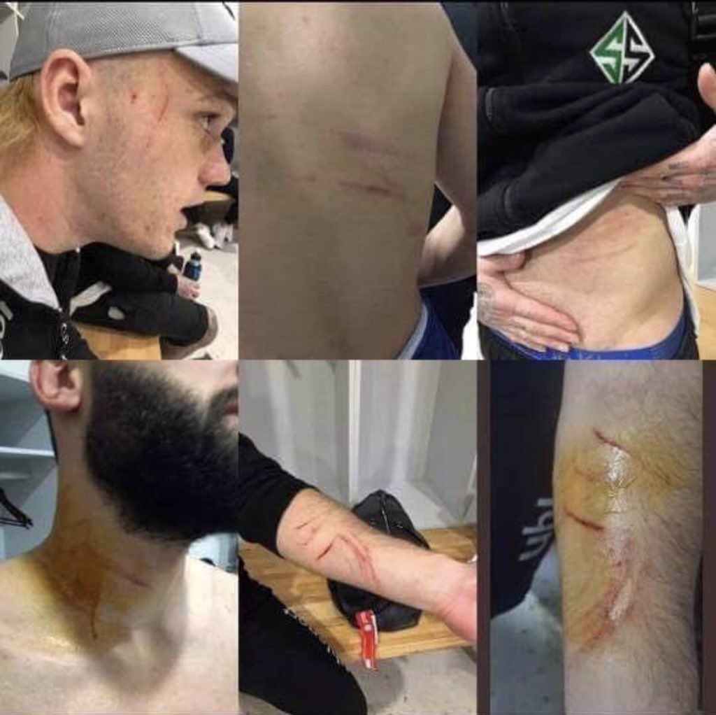 Резаные раны футболистов, фото — Твиттер