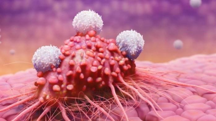 Связь между пародонтитом и вероятностью заболевания раком выявили ученые. Фото: azertac