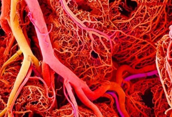 Возрастные изменения в кишечнике и вероятность развития сердечно-сосудистых заболеваний взаимосвязаны. Фото: Научная Россия