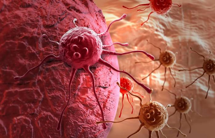 Раковые опухоли: ученые научились выяснять причину недуга по ДНК. Фото: GoldVoice.club