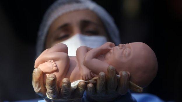 Запрет абортов: в США уже пять штатов законодательно запретили прерывать беременность. Фото: bbc.com