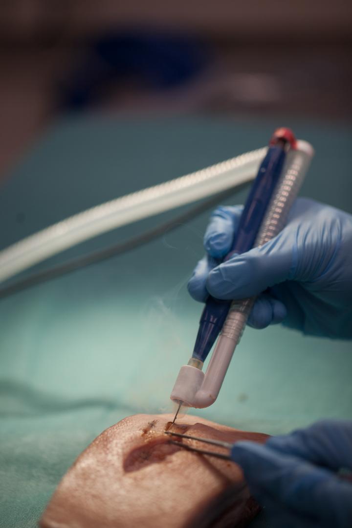 Хирургический дым, создаваемый электрическим ножом, подается непосредственно в систему измерения, фото: Antti Roine
