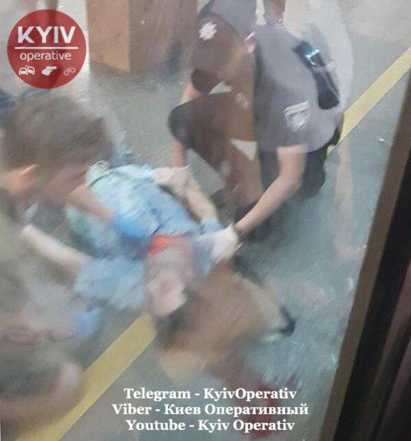 У Києві на “Контрактовій площі” потяг метро вдарив чоловіка в голову. Фото: “Київ Оперативний” у Telegram