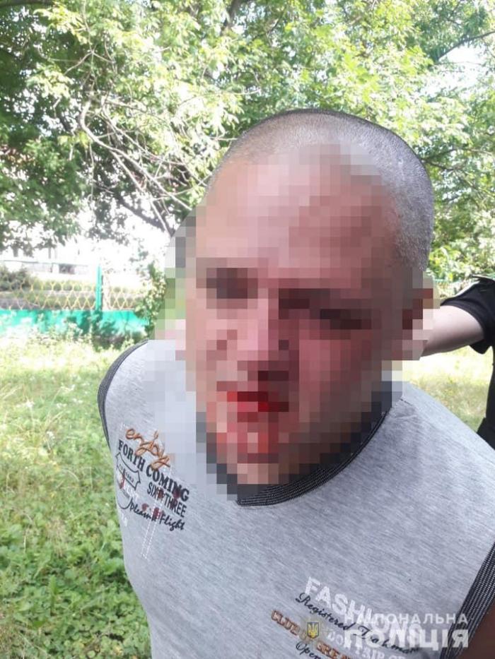Житель Фастова погрожував підірвати гранату в центрі міста, фото: Національна поліція 