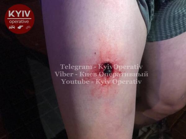 В Киеве пьяные военнослужащие прострелили мужчине ноги. Фото: Киев Оперативный
