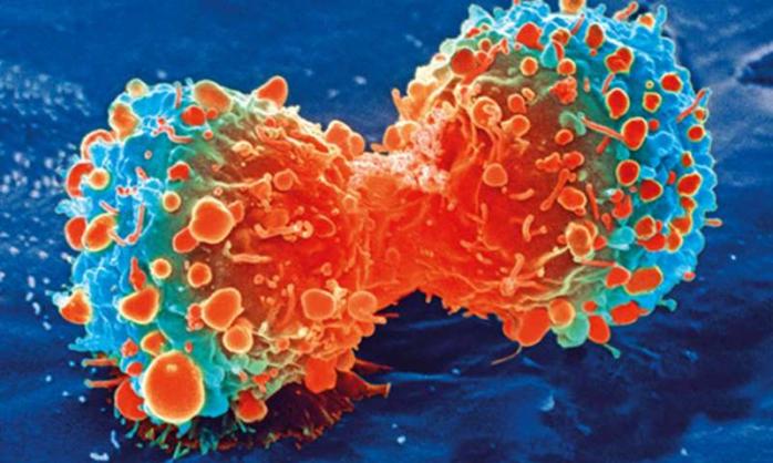 Учені назвали бактеріальні інфекції справжньою причиною розвитку раку, фото: National Institutes of Health