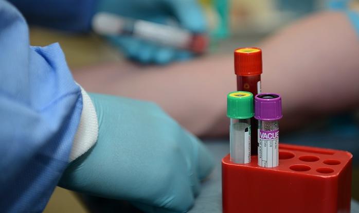 В Австралии и Малайзии зафиксированы первые случаи заболевания коронавируса, фото: Health