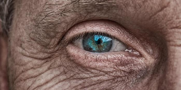 Вікова макулодистрофія – одна з найчастіших причин сліпоти, фото: