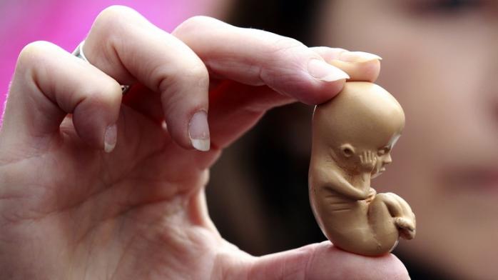 Понад 2 тис. ембріонів знайшли у будинку американського лікаря. Фото: Reuters
