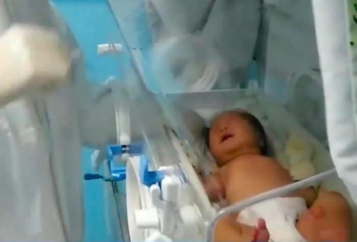 Новорожденная Сяо Сяо, победившая коронавирус. Фото: The Mirror