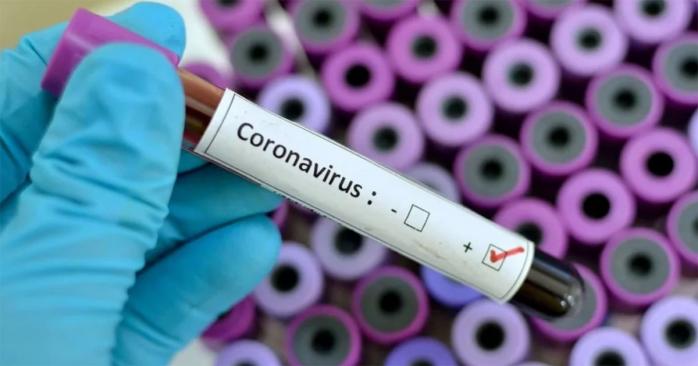 Тести на визначення коронавірусу незабаром надійдуть у регіони. Фото: 