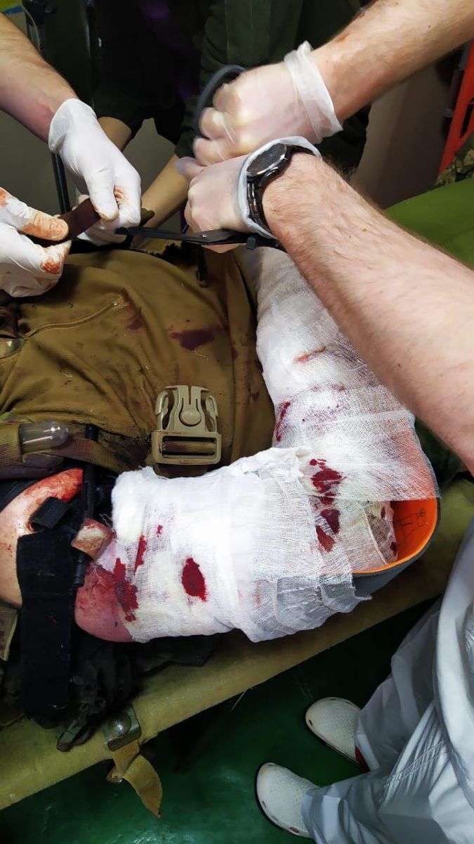 Раненый украинский боец. Фото: Анатолий Цаплиенко в Telegram