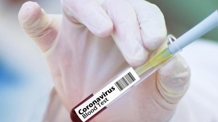 В Украине растет количество умерших от коронавируса