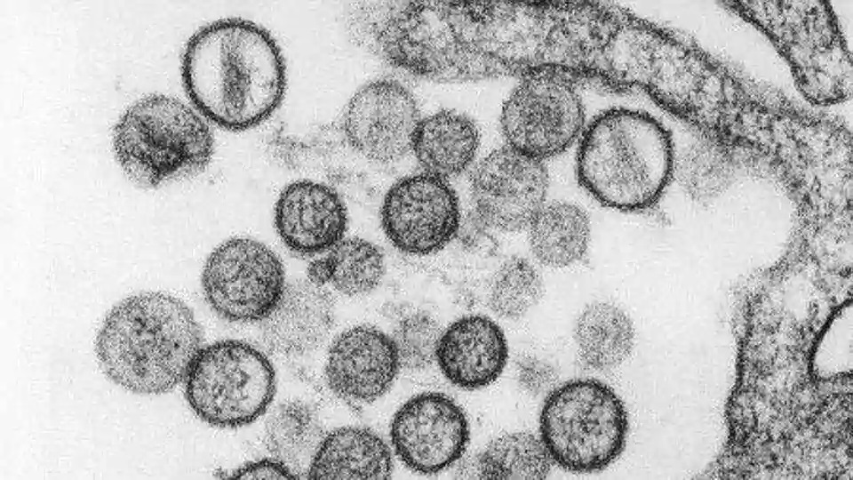 Хантавирус из Китая: что это за вирус и почему не стоит паниковать