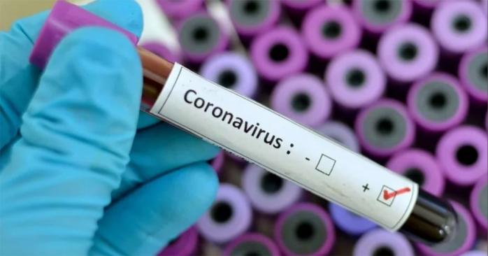 Фальшиві тести на коронавірус виявили в Києві. Фото: 112 Україна