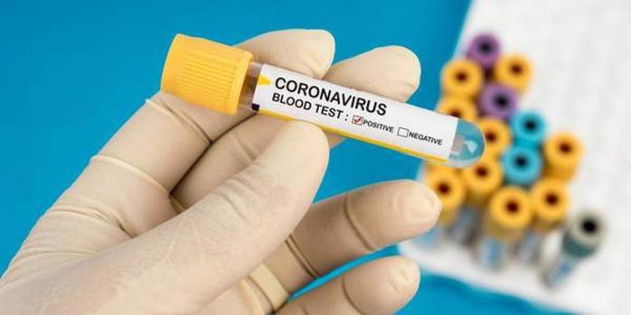 Тесты на коронавирус делают всем заболевшим пневмонией - Ляшко