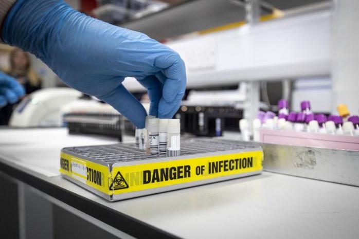 У світі розробляють 120 вакцин від коронавірусу. Фото: Getty Images