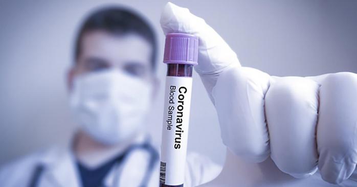 Ученые тестировали вакцину на макаках. Фото: eadaily.com