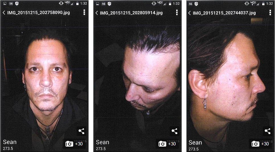 Джонни Депп показал скандальное фото с синяком. Фото: Daily Mail