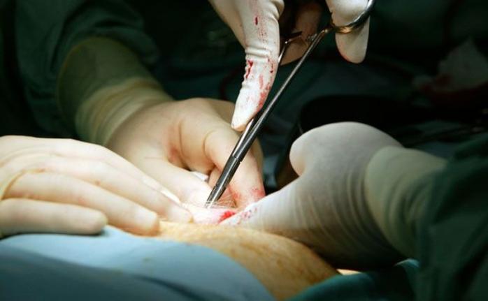 Сложную операцию по трансплантации органа впервые провели в Украине. Фото: АиФ