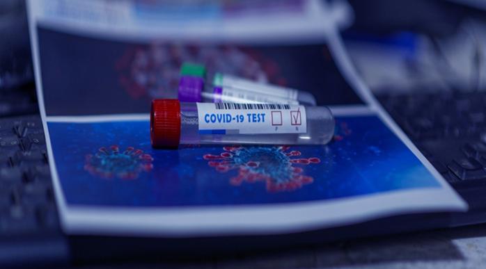 Тести на коронавірус. Фото: Pixabay