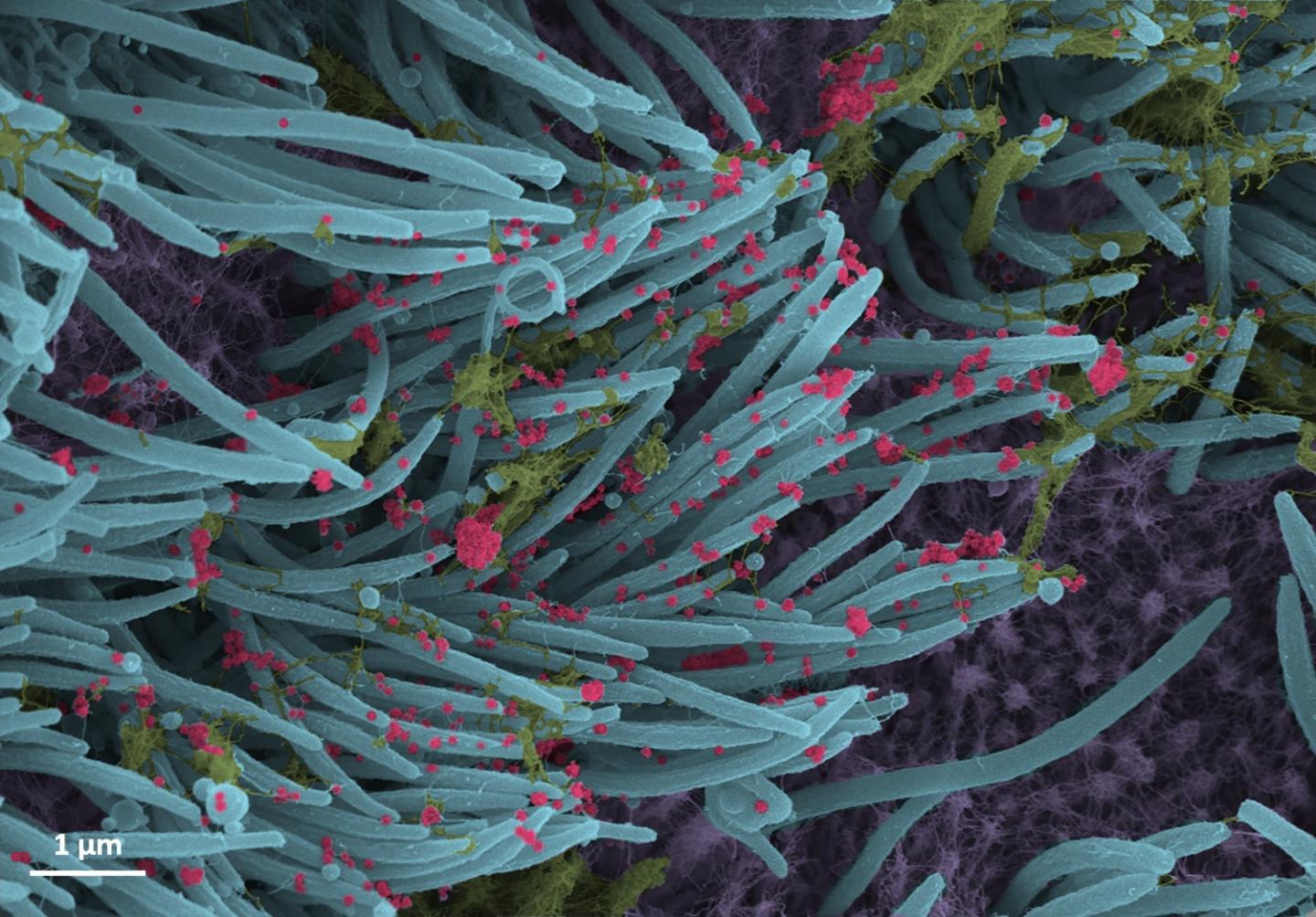 Зображення показує структуру та щільність віріонів SARS-CoV-2 (червоний колір), що утворюються епітелієм дихальних шляхів людини, фото: Ehre Lab, UNC School of Medicine