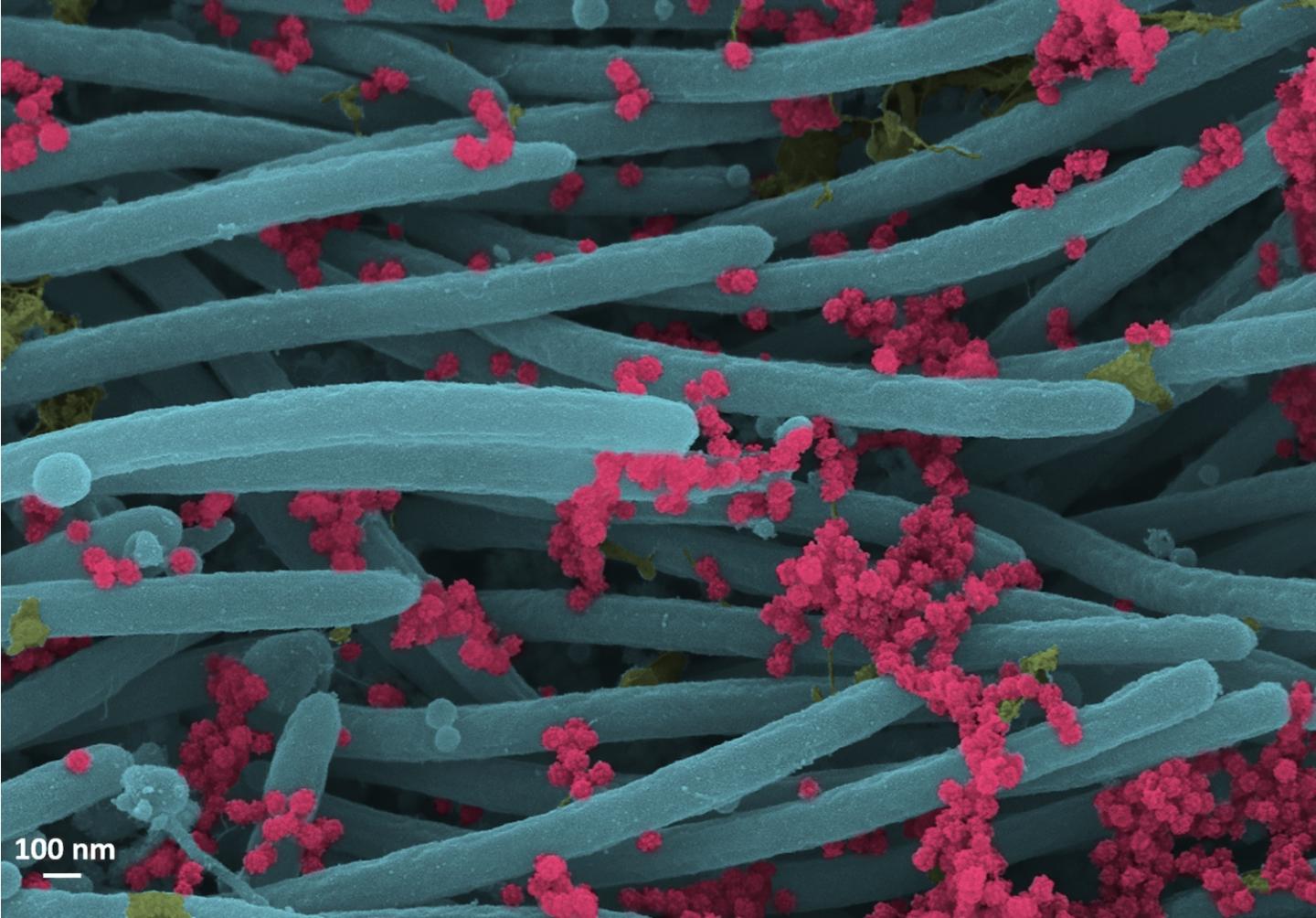 Віріони коронавірусу (червоний колір), фото: Ehre Lab, UNC School of Medicine