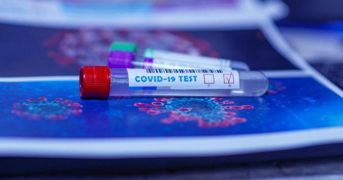Епідемія коронавірусу в Україні триває