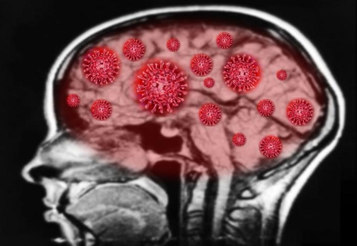 Способность коронавируса проникать в мозг подтвердили немецкие ученые