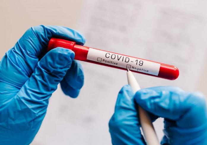 Тест на коронавірус. Фото: Pixabay