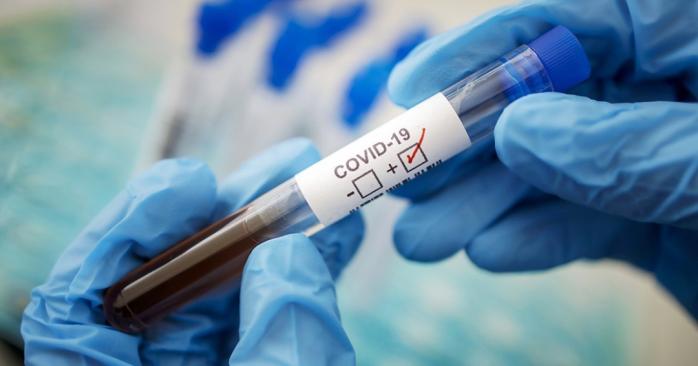 Сократить срок тестирования на коронавирус хотят в Минздраве. Фото: ckp.in.ua